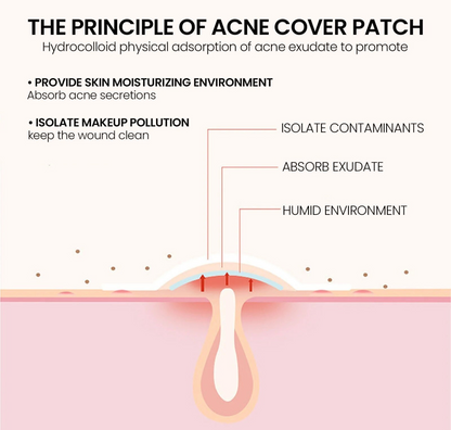 Purify Acne Patches (Pack of 36)