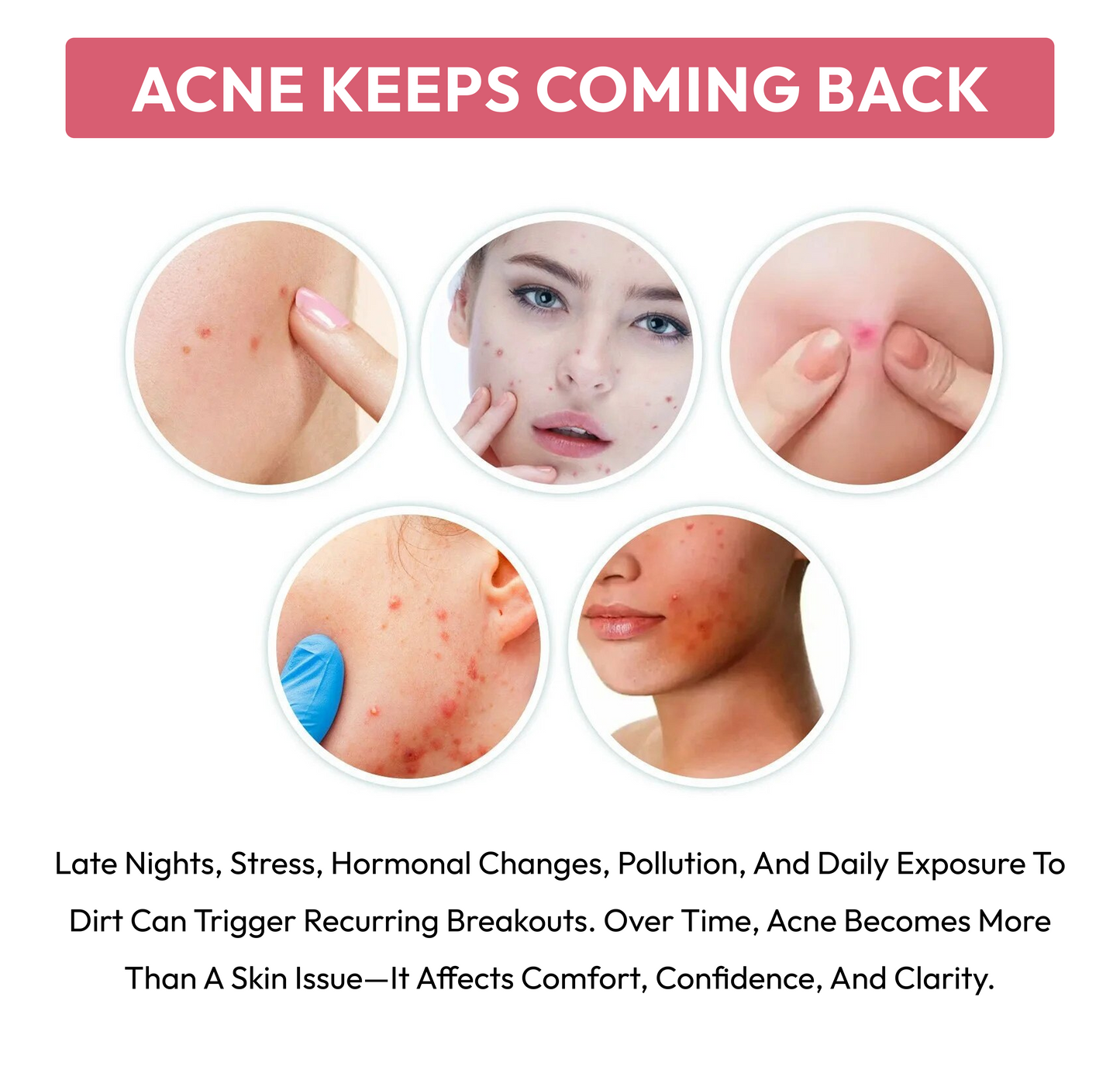 Purify Acne Patches (Pack of 36)